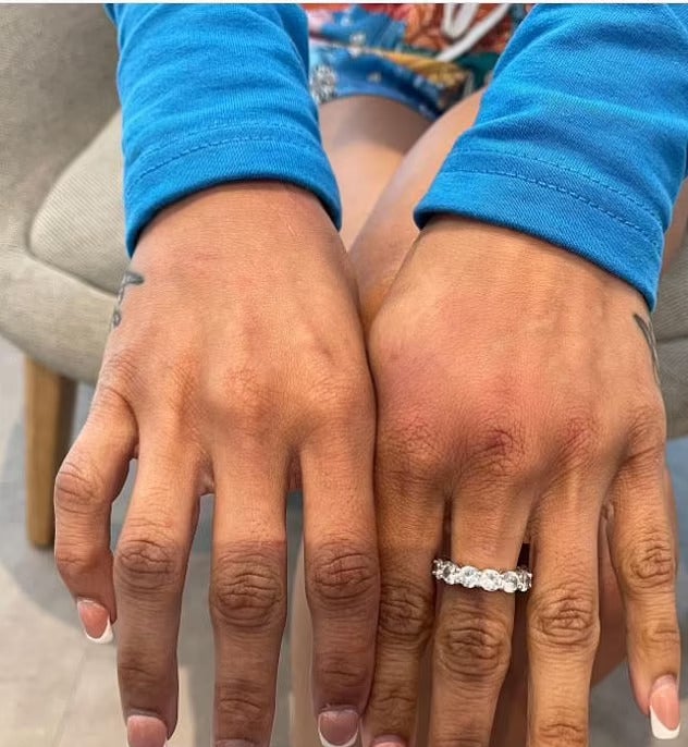 Mychelle Johnson posted images of her injuries on social media