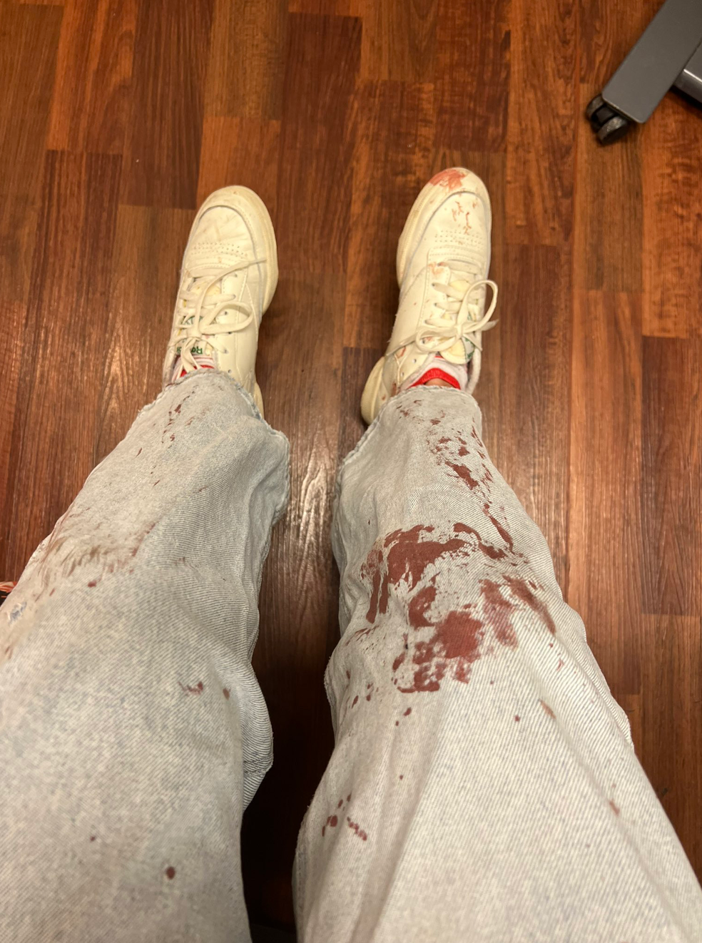 Lilli shared a photo of her blood-spattered jeans after the July 4th parade mass shooting