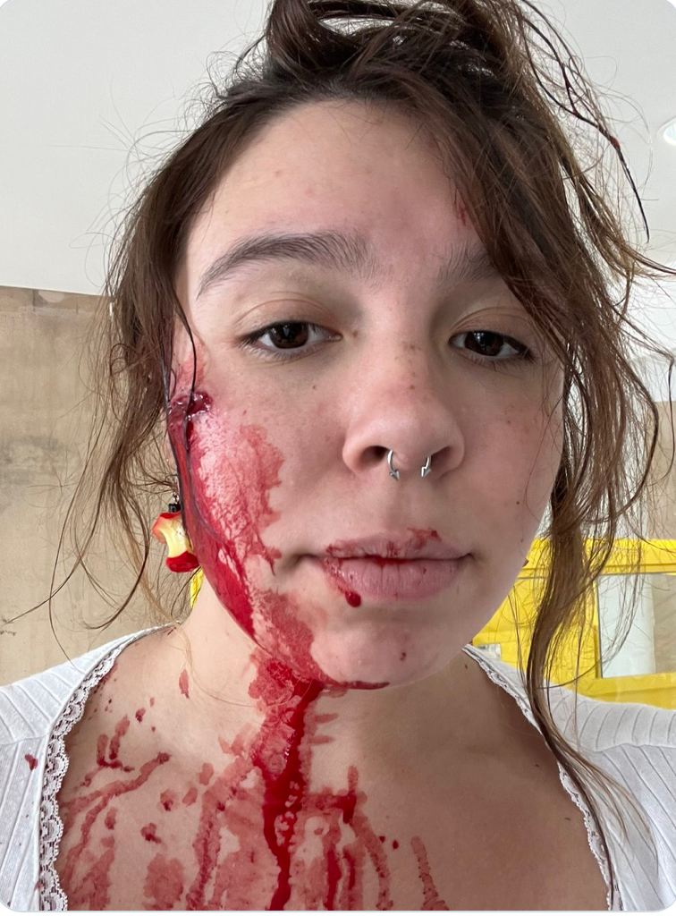 A young woman known as Lilli shared photographs of her injuries sustained in the Highland Park mass shooting