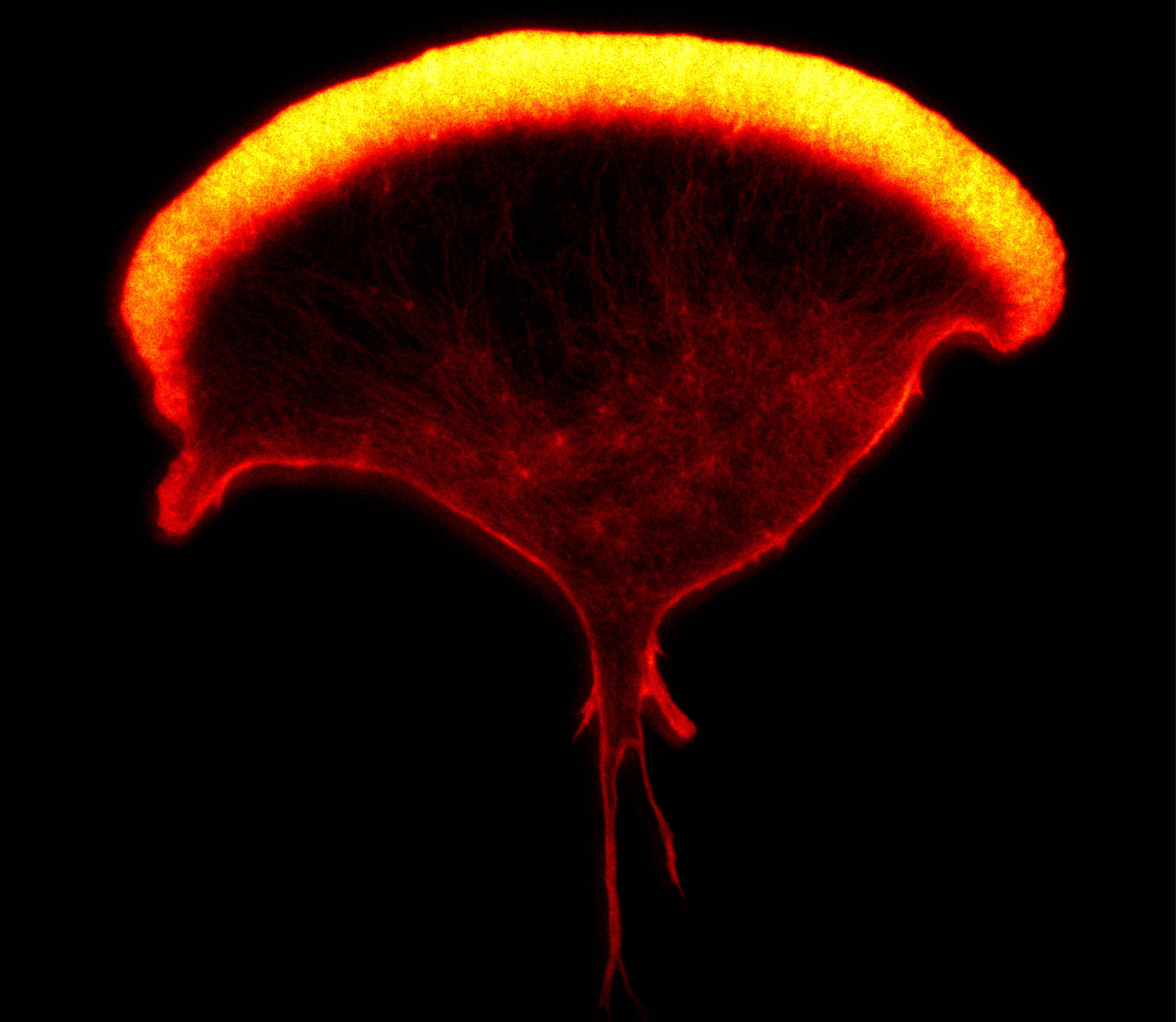 A human natural killer cell pictured using Stimulated Emission Depletion (Sted) microscopy