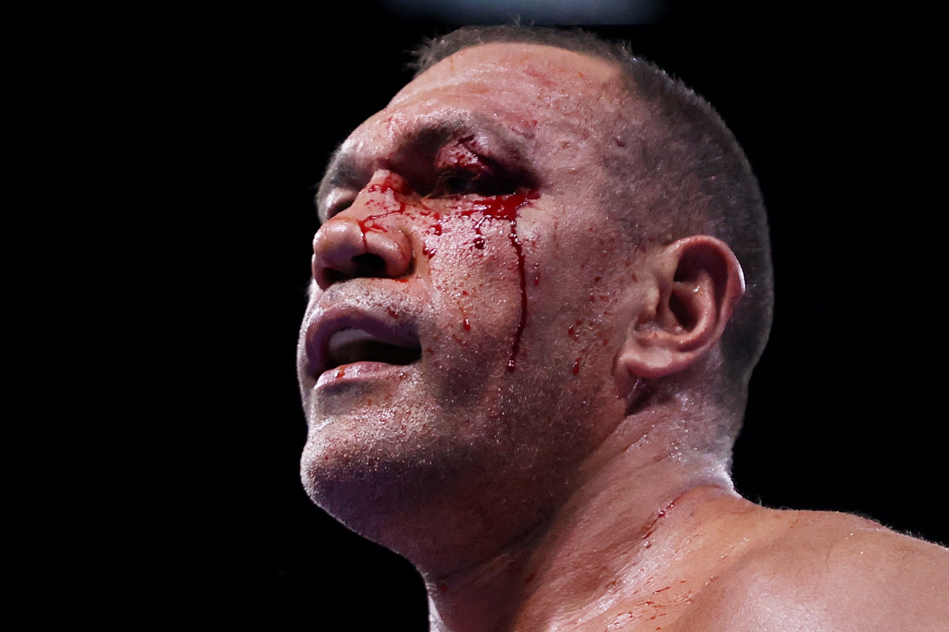 Pulev sustained two severe cuts during the fight