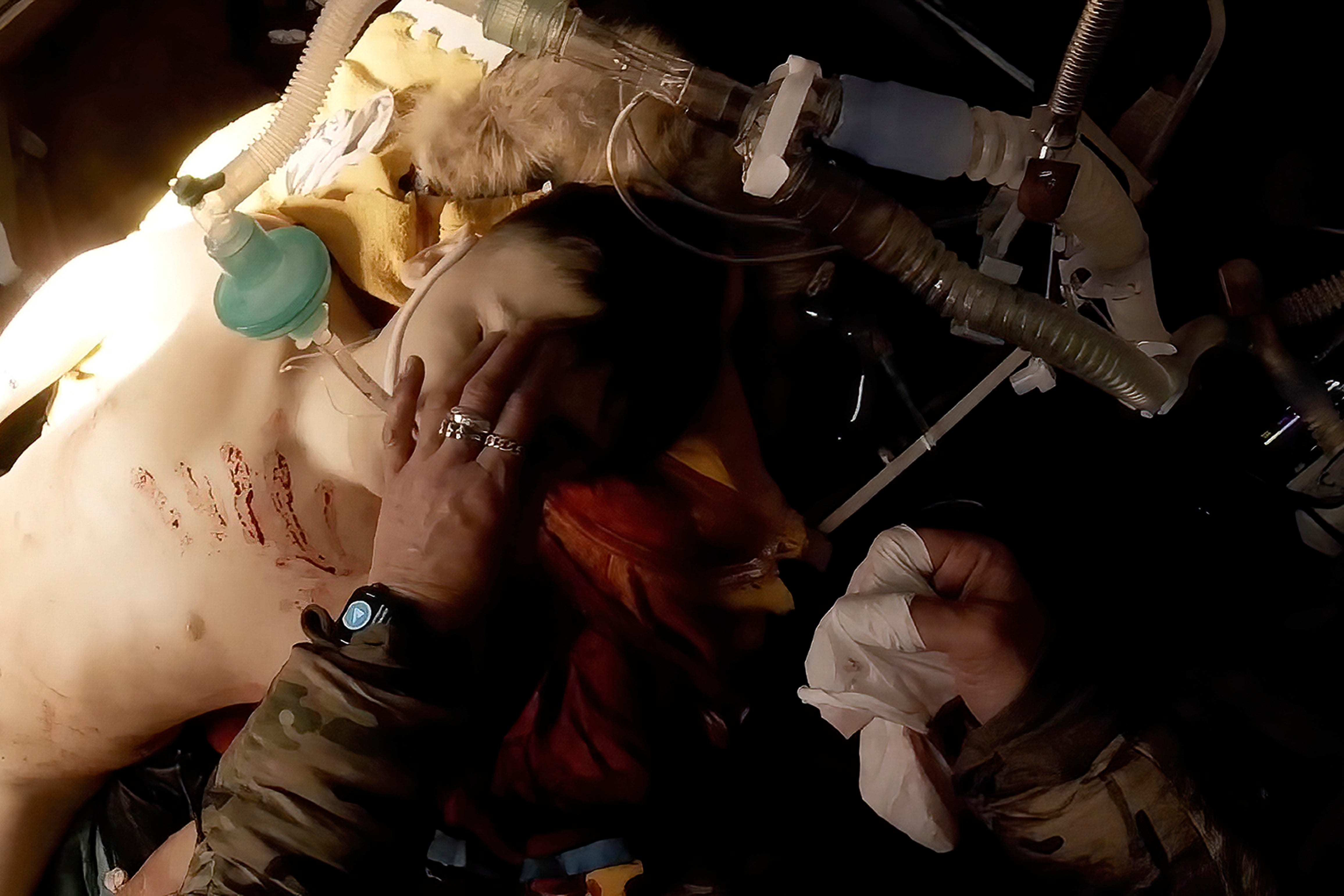 Ukraine Mariupol Medic Freed