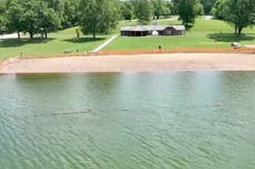 Patient dies from brain-eating amoeba after trip to Iowa lake
