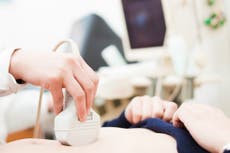 Maternity failings account for the majority of the NHS’s £13bn spend on negligence