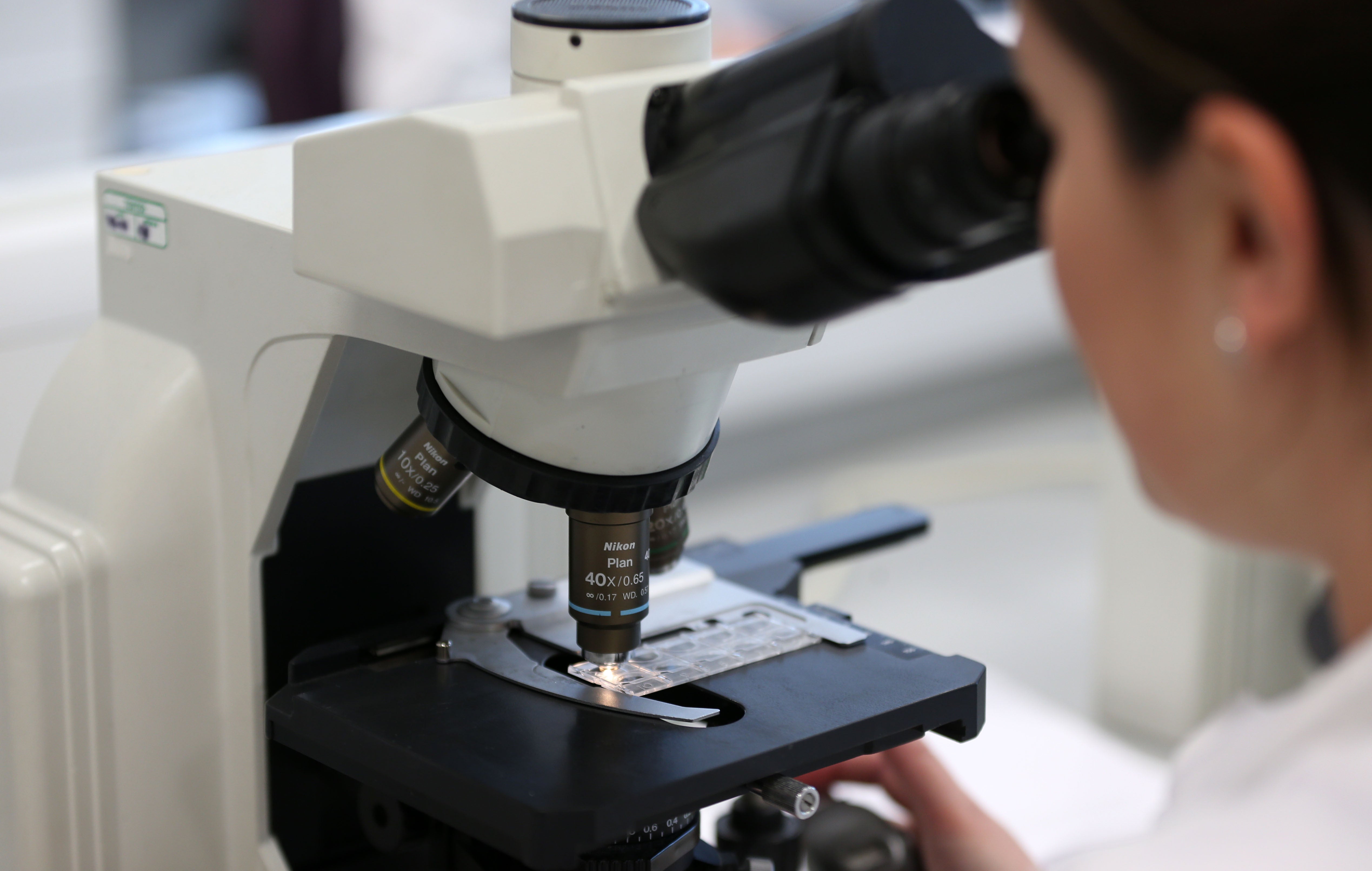 A general view of a woman using a microscope, as new research sheds light on the causes of acute hepatitis in children (Lynne Cameron/PA)