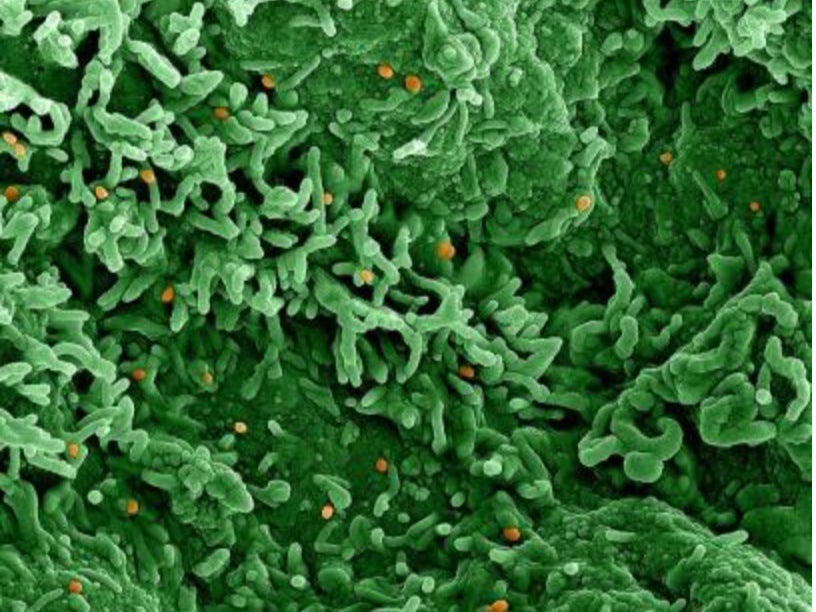 Infection threat: Colorised scanning electron micrograph of monkeypox virus (orange) on the surface of infected Vero E6 cells (green).