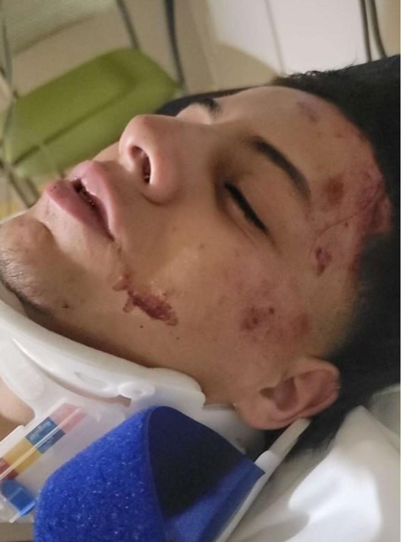 Hadi Abuataleh is in hospital with fractures and severe bruising, his mother says