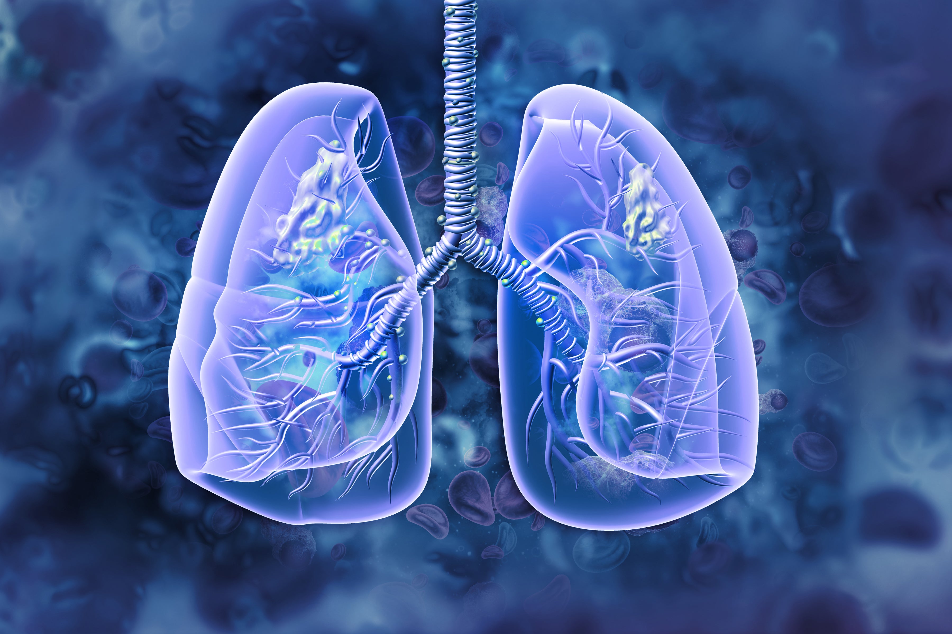 A faster and more accurate diagnosis of common lung conditions