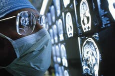 Victims of racism more likely to suffer poorer brain function and memory loss in later life, study suggests