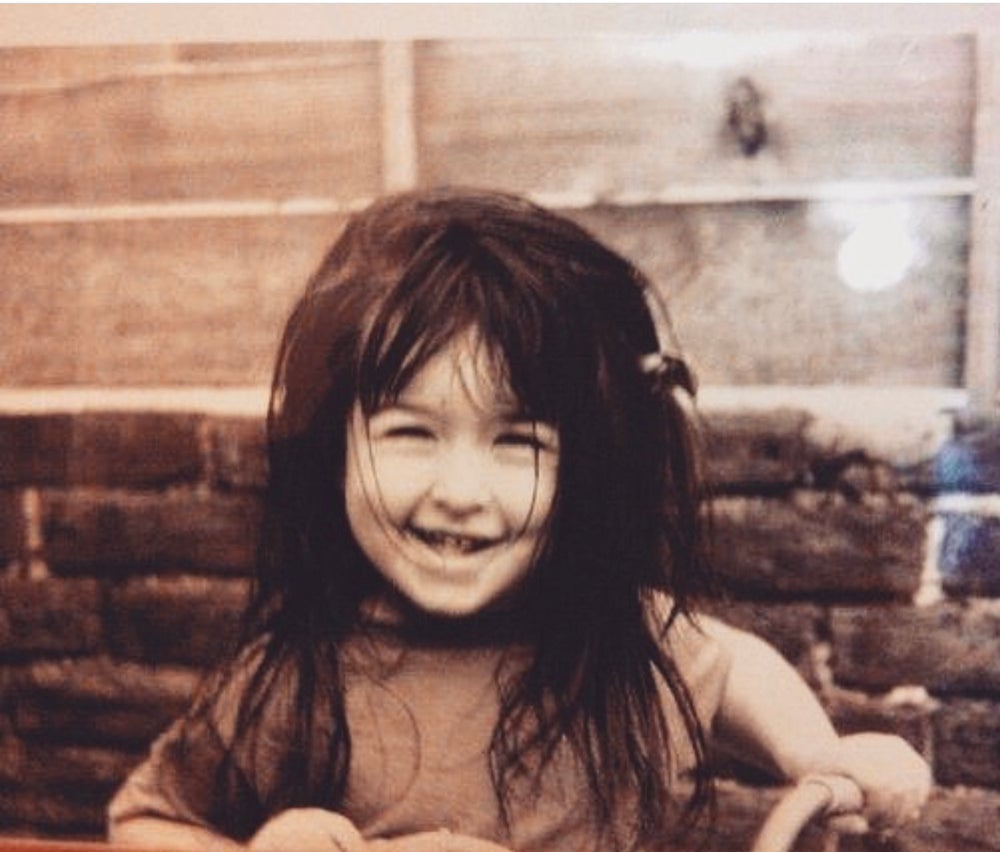 Rosie Myers when she was three-years-old with a full head of hair (Collect/PA Real Life)