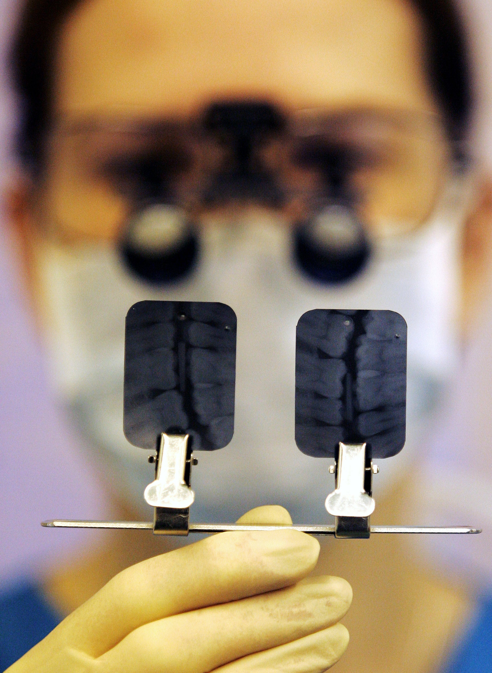 NHS dentistry is at a ‘tipping point’, said the British Dental Association