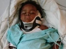 Teen babysitter saves baby mauled by pit bull 