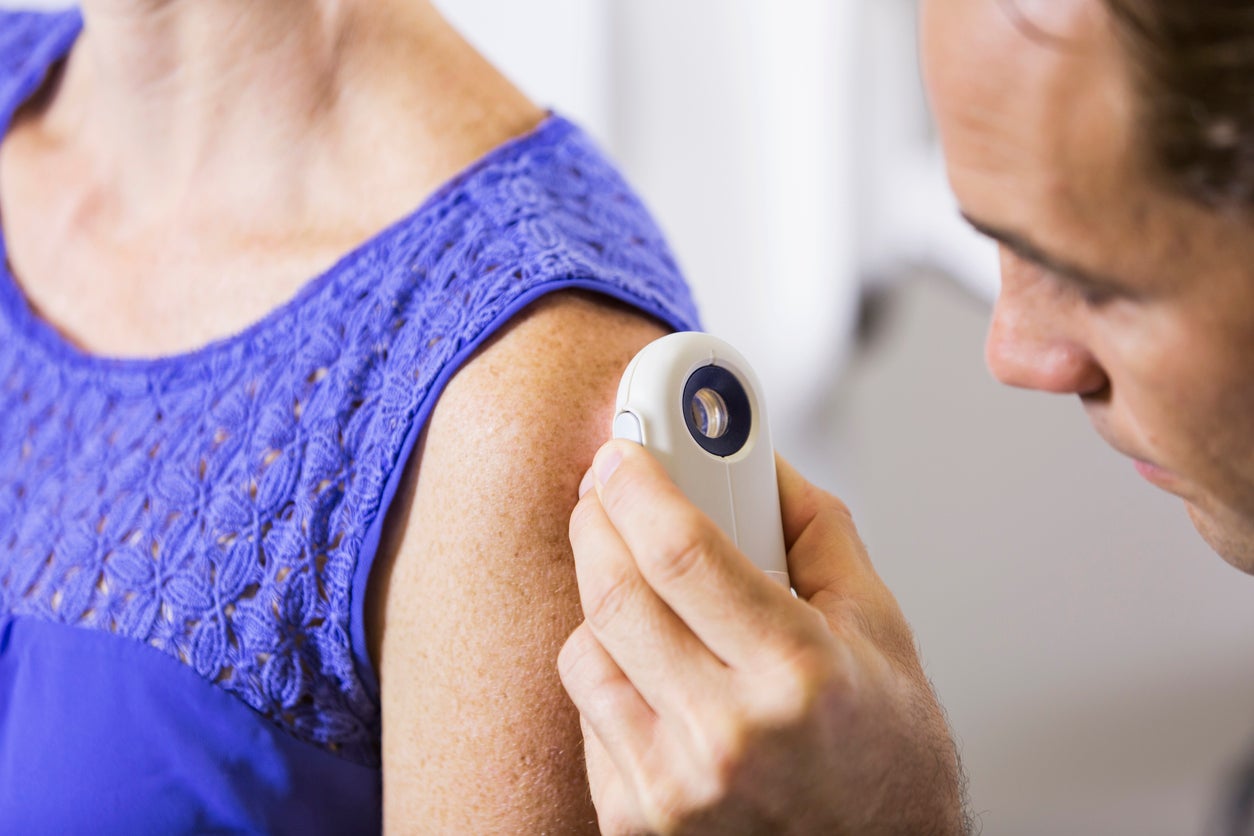 About 20,800 new cases of melanoma are diagnosed in the UK every year