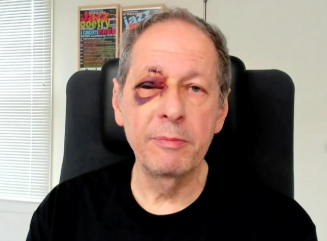 Henry Reese suffered a stab wound and black eye while trying to defend Salman Rushdie