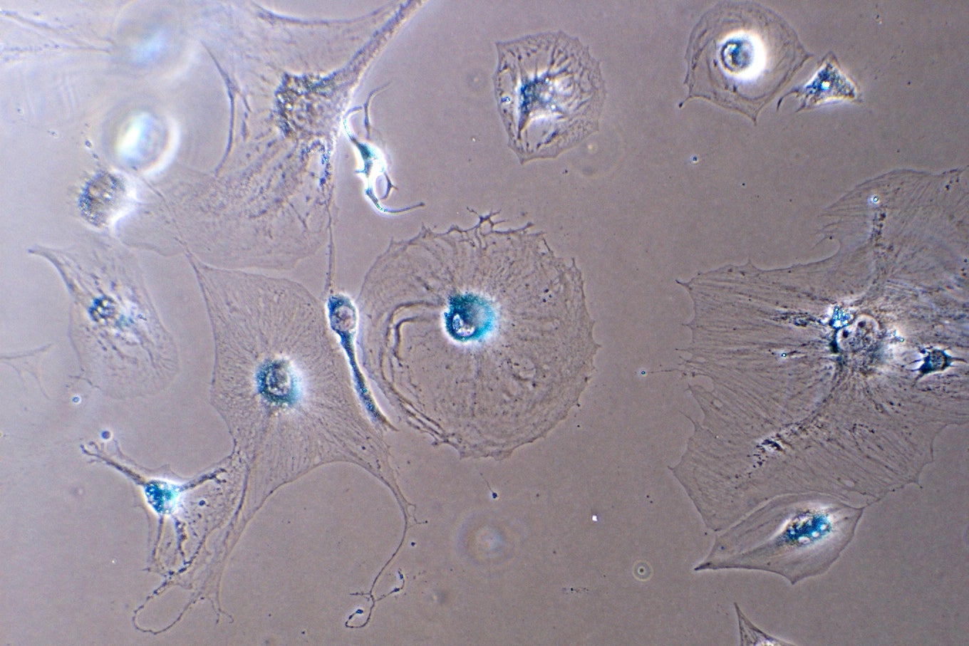 Zombie Cells-Healthy Aging