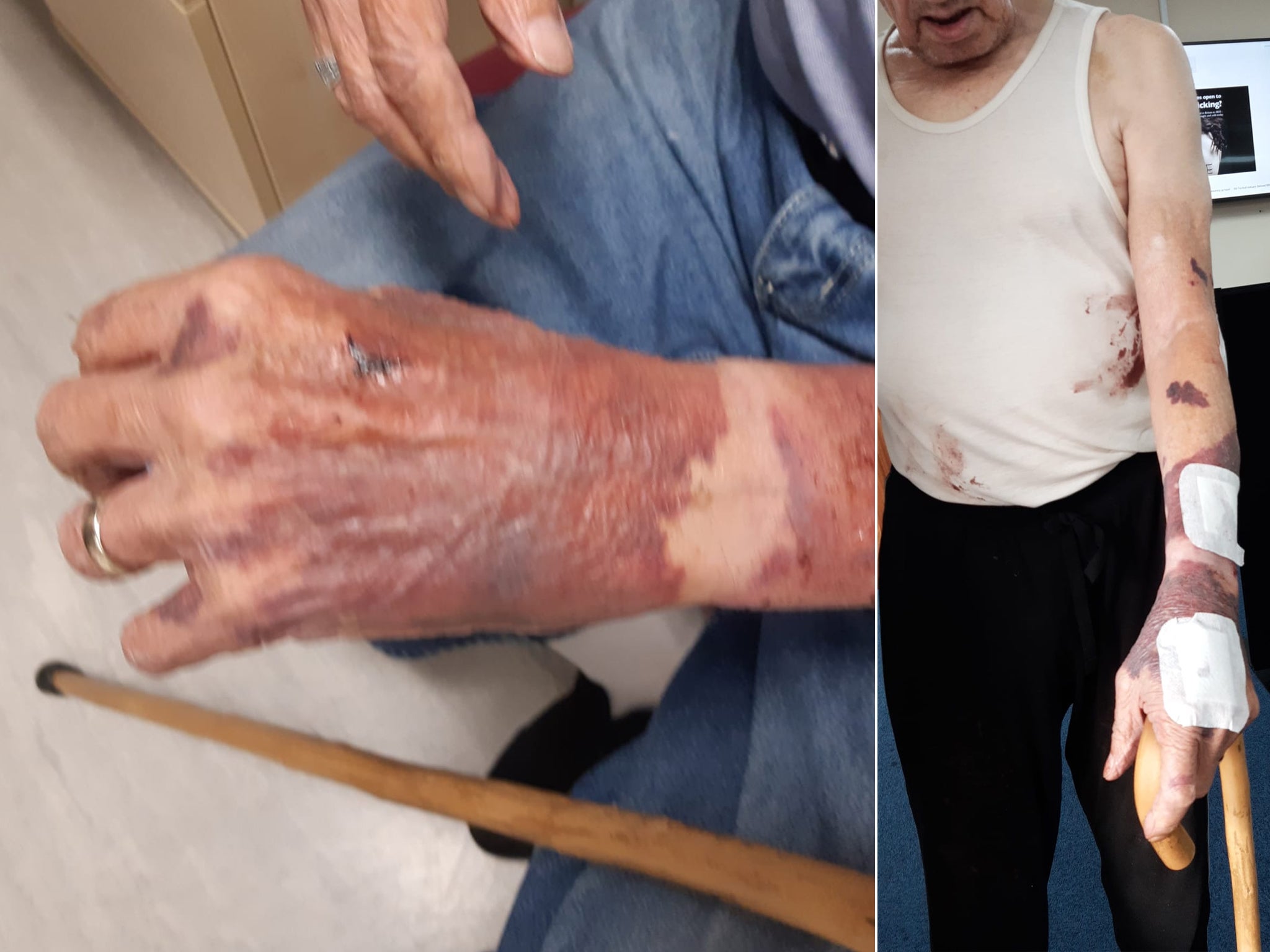 Woman said arrest left her grandfather ‘confused and bruised’ in cells