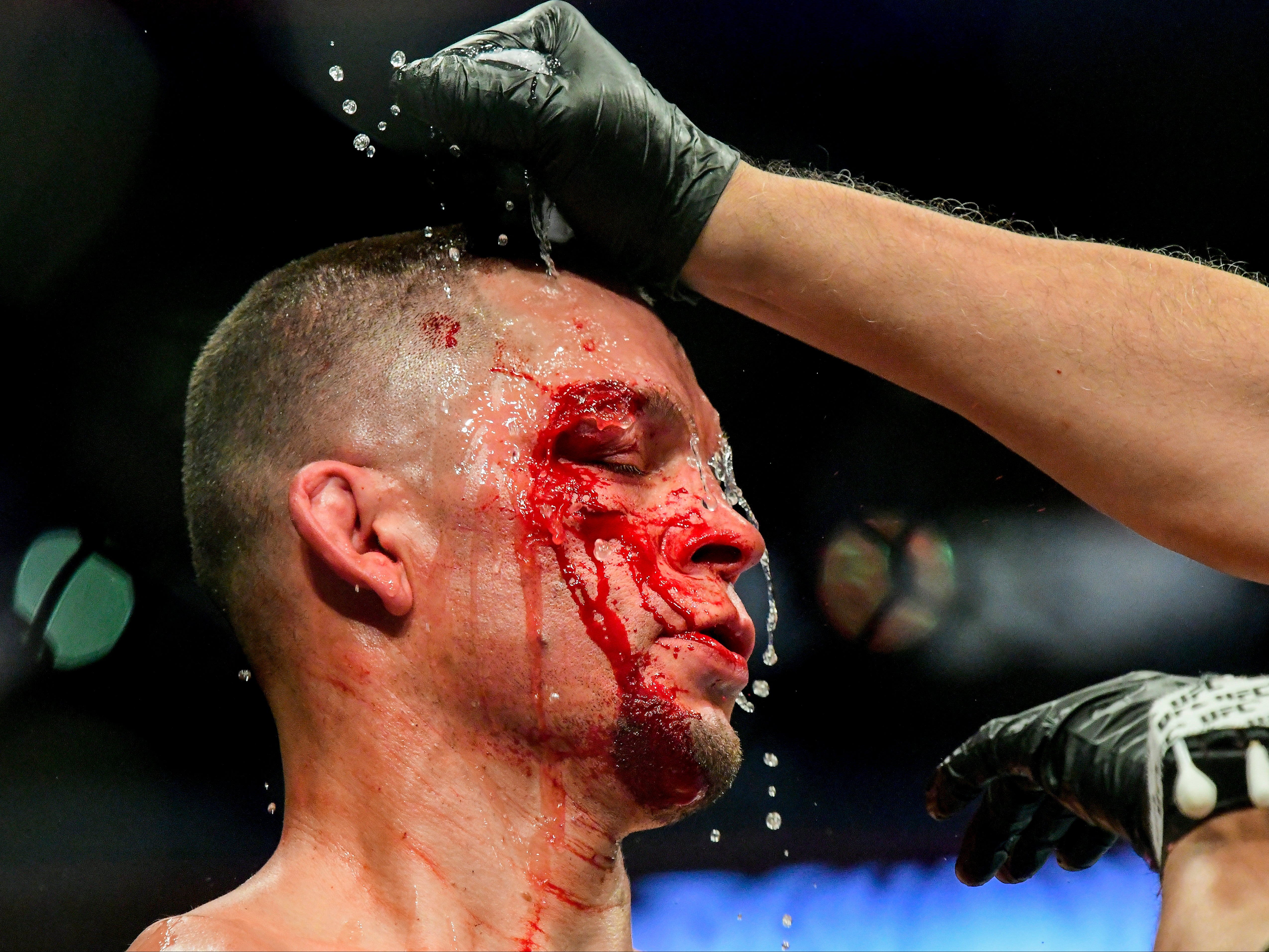 UFC 279: Is Nate Diaz being put out to pasture in Khamzat Chimaev fight?