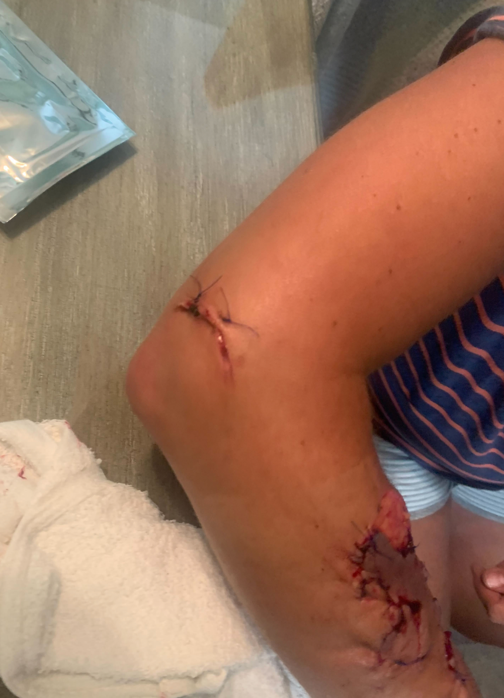 Ms Sites instinctively pushed the shark away with her free arm but remained in disbelief at what had just happened