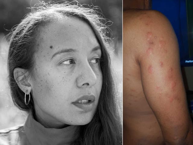 <p>Jade Sullivan  </p>