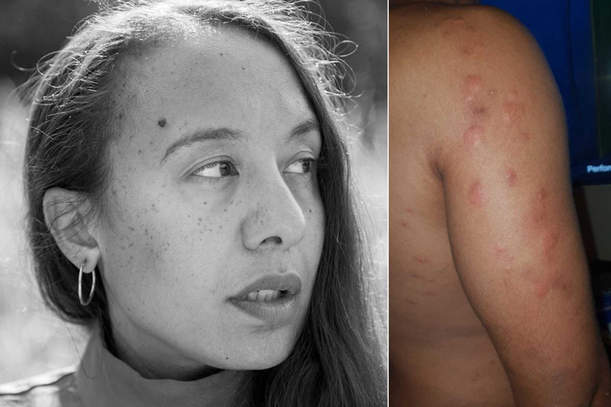Housing provider ‘neglects' young family for four years with bed bug infestation and mould outbreak