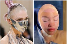 Grimes finished new album at ‘plastic surgery clinic’ amid elf ear rumours