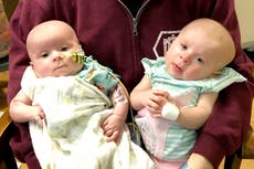 Mother’s heartbreak as twin daughters both diagnosed with rare eye cancer