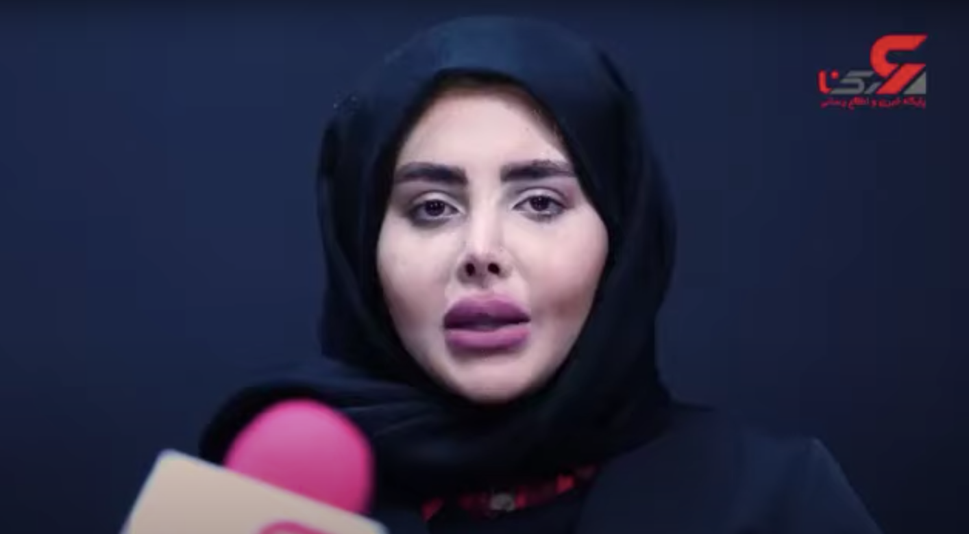 Sahar Tabar showed her real face after her release from prison