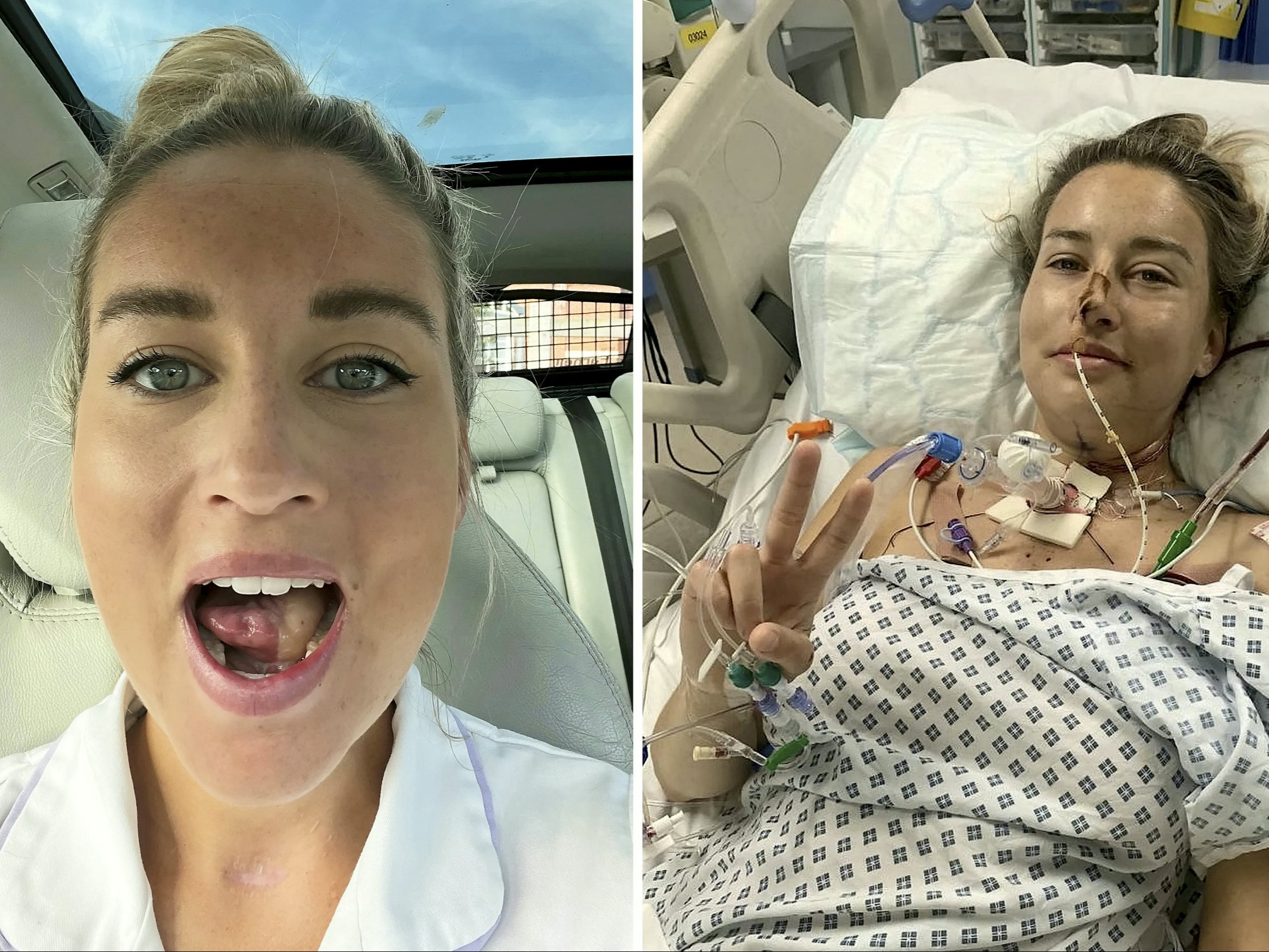 Mouth cancer causes grow as cases skyrocket in UK