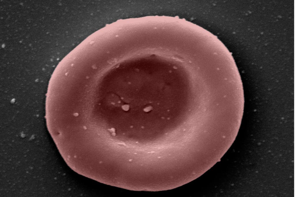 ‘Lab-grown red blood cells transfused in to person in a world first’