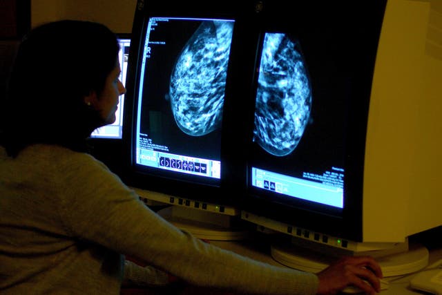 <p>New drug for triple negative breast cancer approved for NHS use</p>