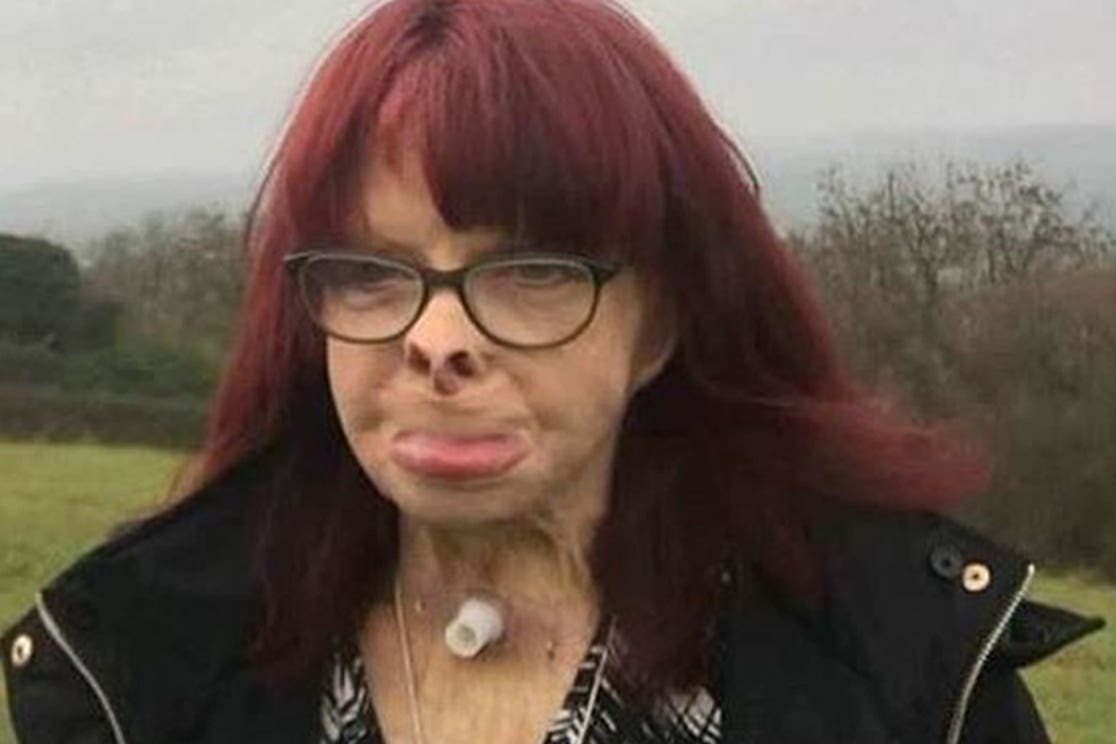 Jackie Kirk died 21 years after being set alight by Steven Craig (Avon and Somerset Police/PA)