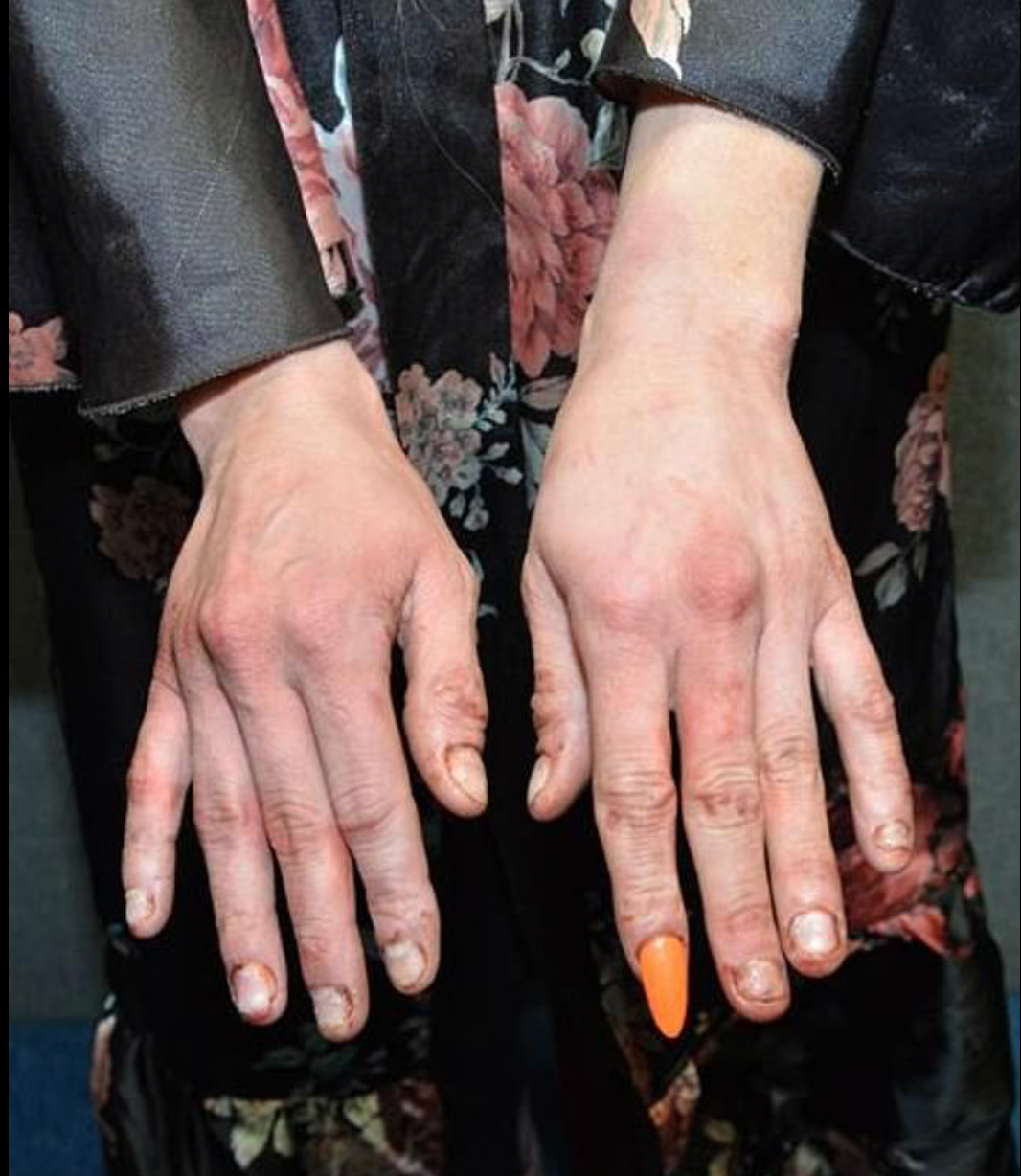 Courtney Clenney’s blood-stained hands and fingernails after the 3 April stabbing