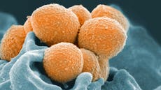 Boy, 12, dies from Strep A infection as parents warned to be vigilant