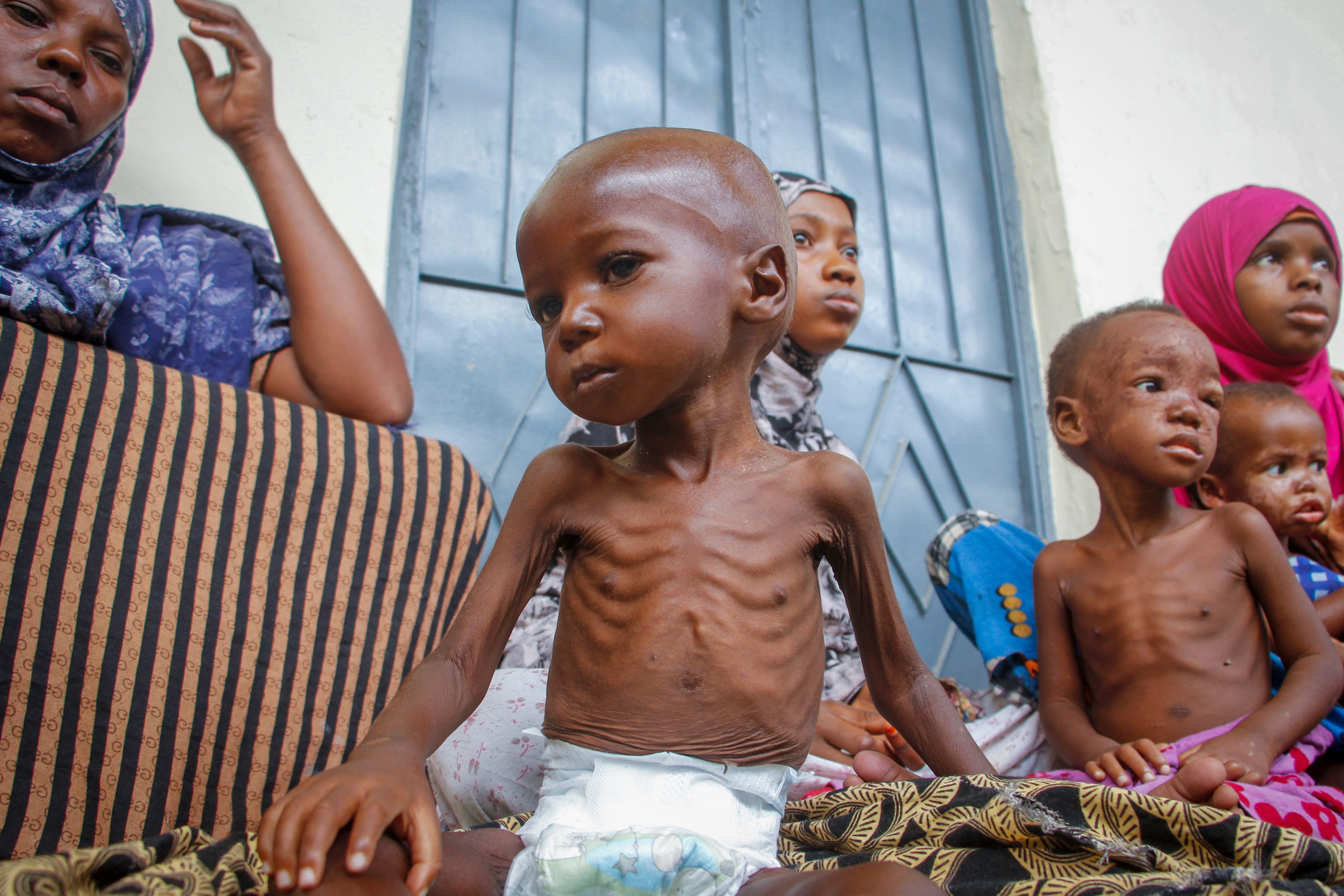 A malnourished two year-old child with his mother, left, who was recently displaced by drought, at a malnutrition stabilisation center run by Action against Hunger, in Mogadishu, Somalia in June 2022