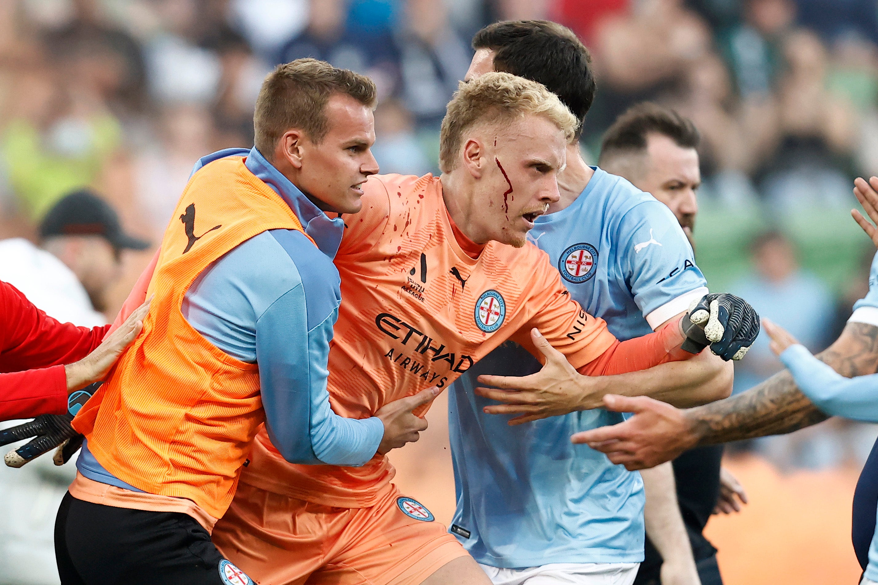 A bleeding Tom Glover of Melbourne City is escorted from the pitch by team mates after fans stormed the pitch