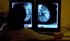 Breakthrough new NHS drug can delay spread of breast cancer