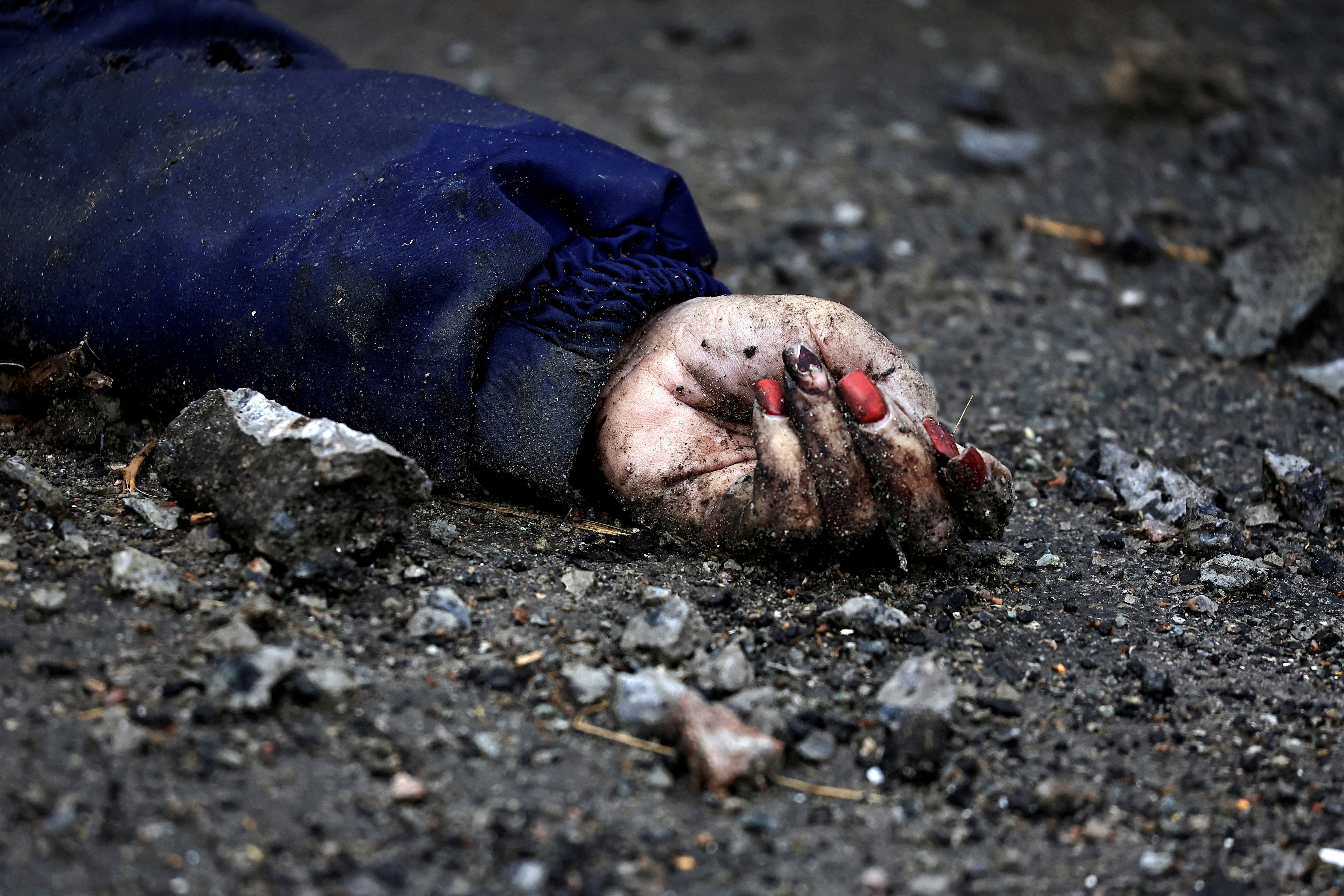 The hand of Iryna Filkina, a woman who according to residents was killed by Russian army soldiers, is pictured as her body lies on the street, after Russia invaded Ukraine
