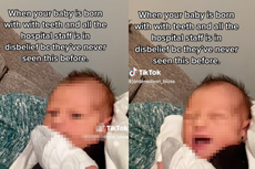 Mother says hospital staff was ‘in disbelief’ when her baby was born with teeth