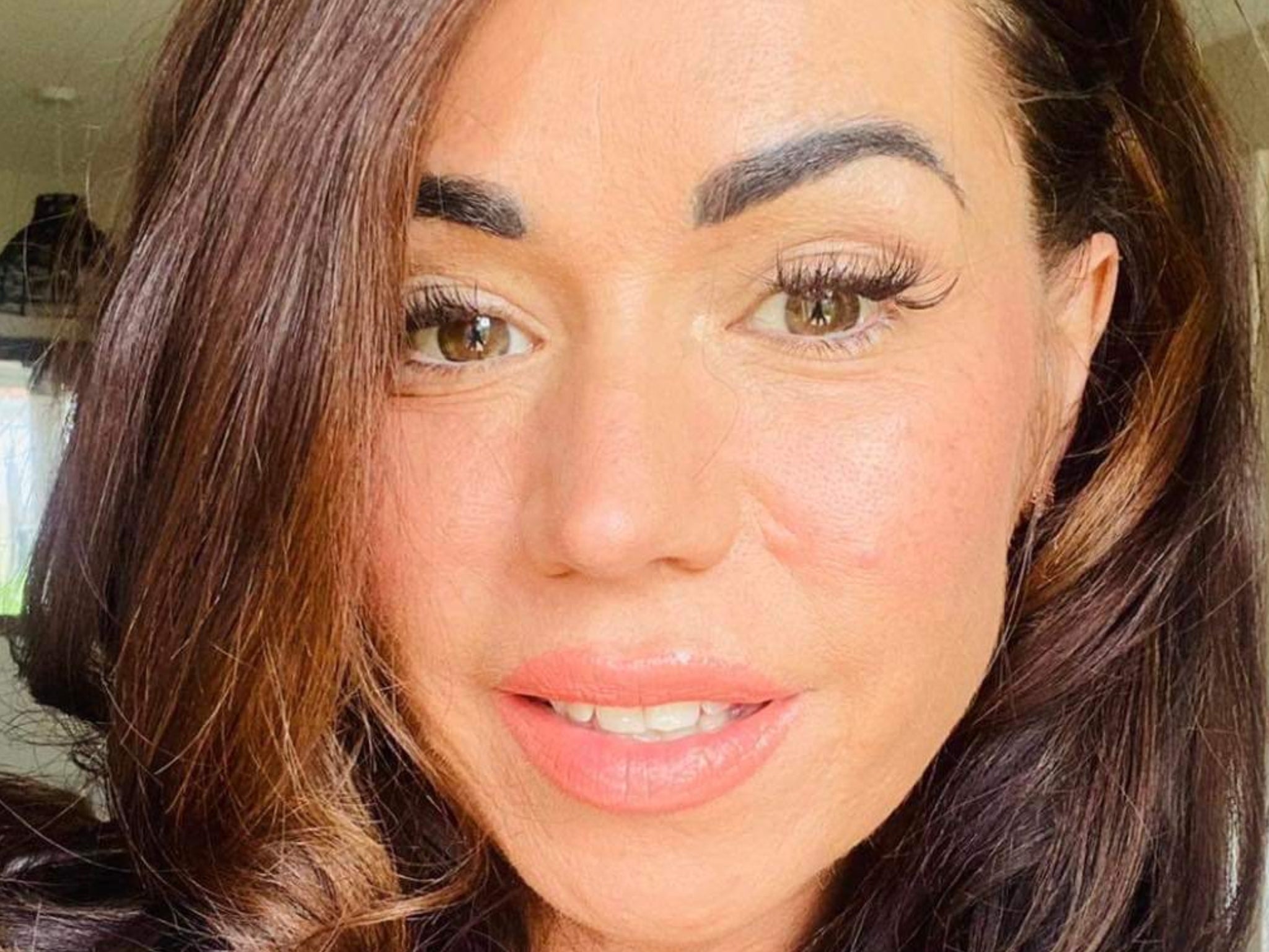 Woman diagnosed with cervical cancer after thinking it was endometriosis 