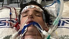 Super-fit teen spends 10 days in a coma after catching the flu