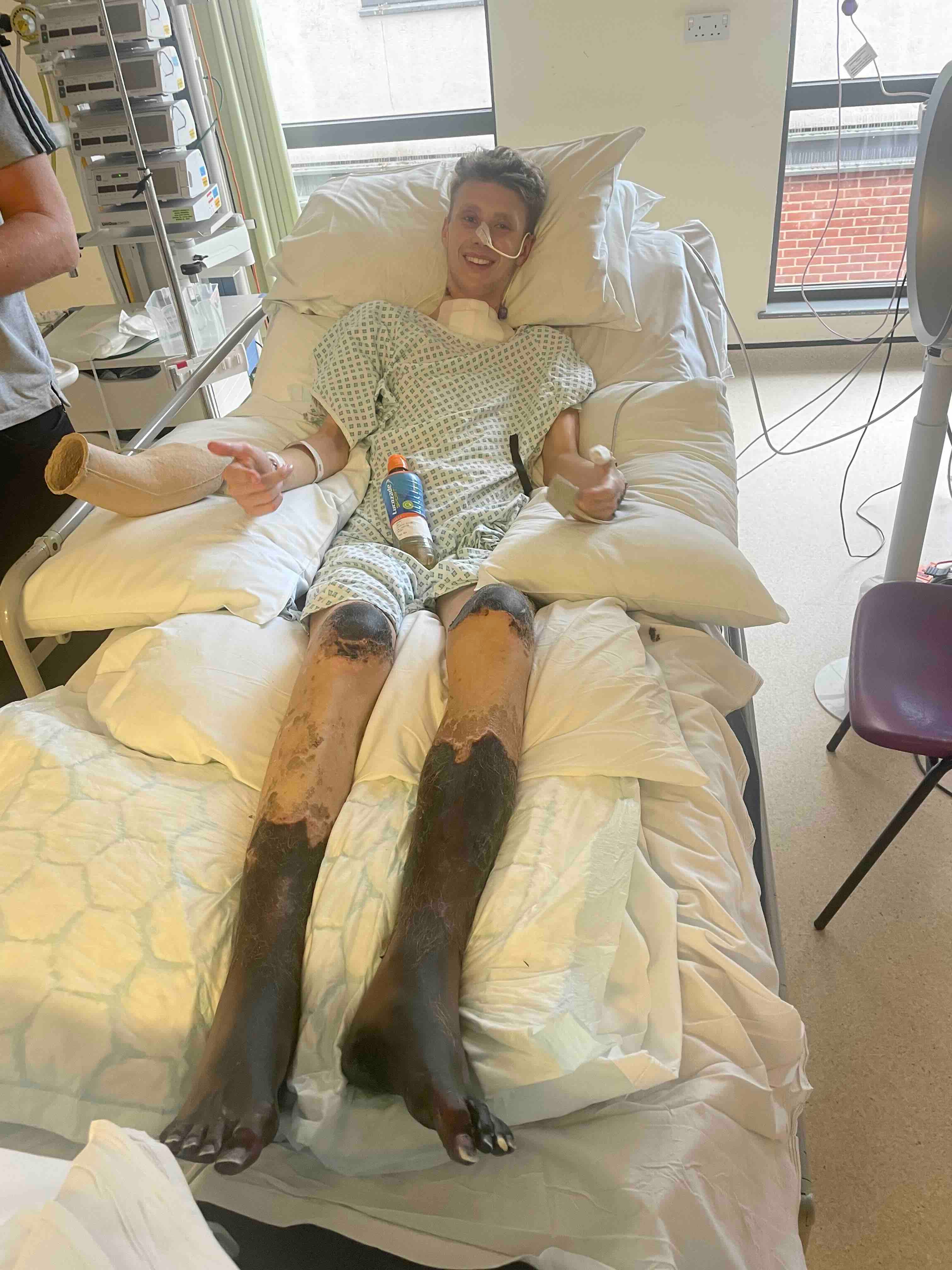 Footballer who went to hospital with flu symptoms has legs amputated days before 21st birthday 