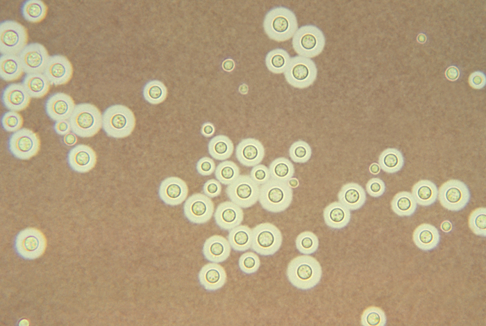 Fungal pathogen Cryptococcus neoformans has been causing an increasing number of life-threatening infections