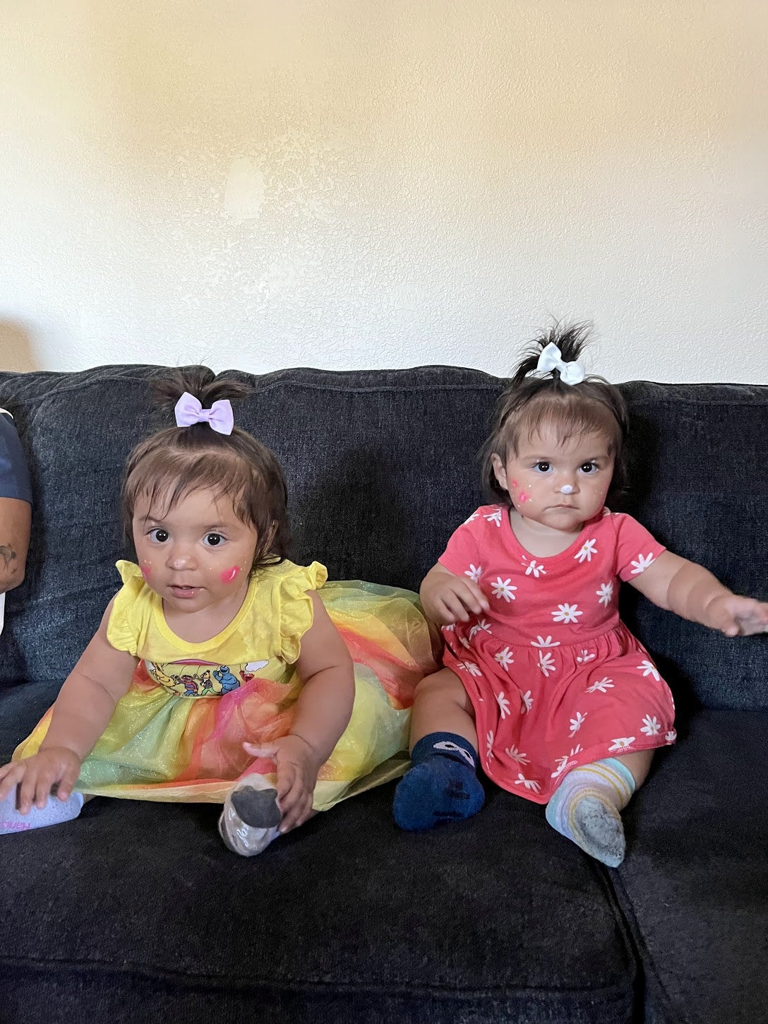 The mum-of-two was told by the ultrasound doctor babies Lilo and Imelda - who were born last year - were measuring differently and had been conceived at different times.