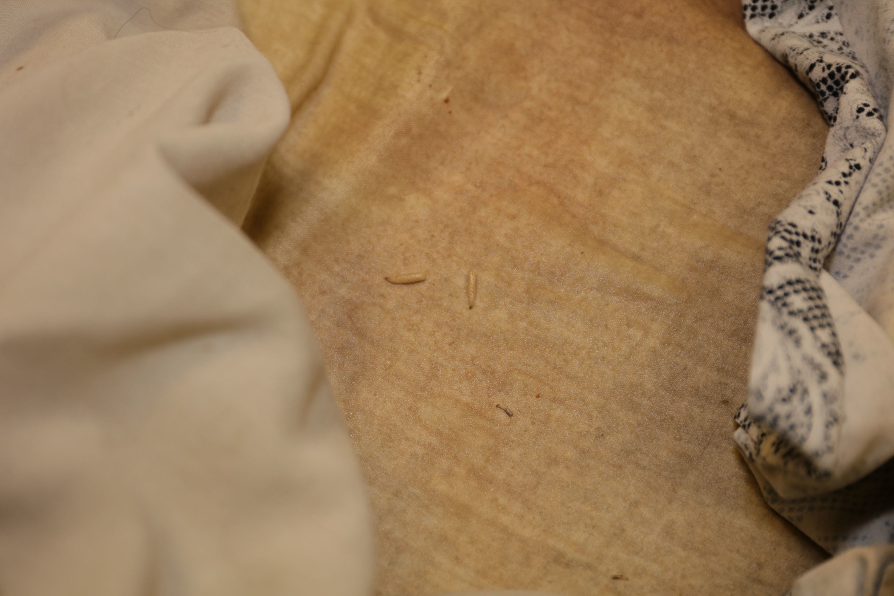 Larvae on bedclothes in Kaylea’s bedroom