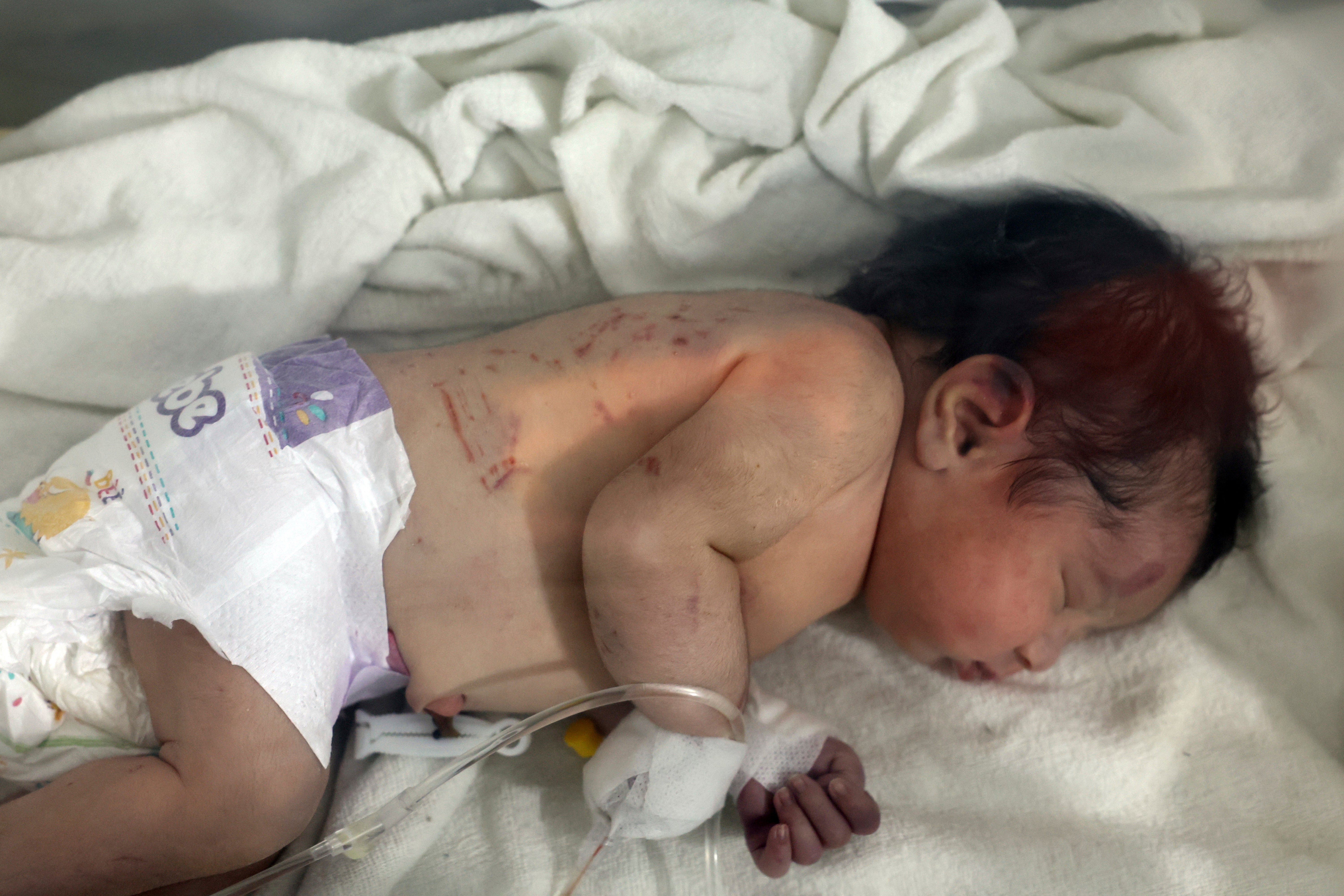 Syria Turkey Earthquake Newborn Rescue