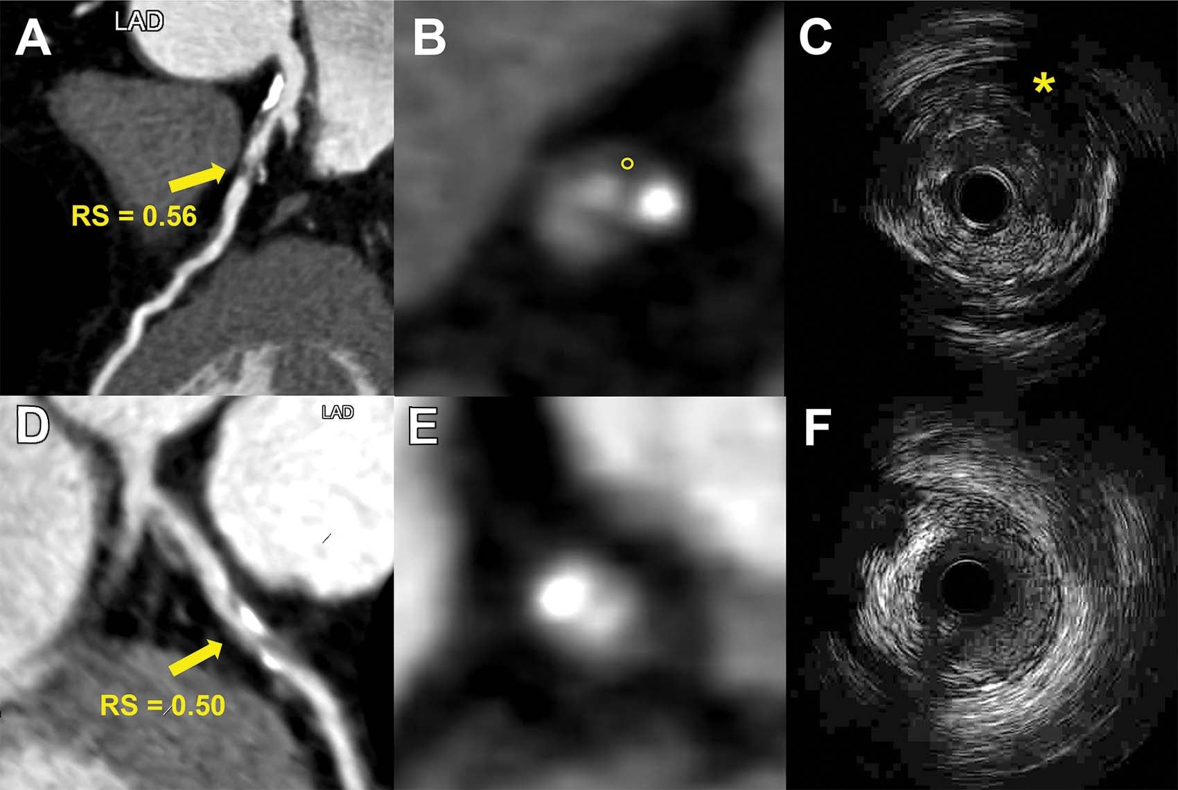 The scans could be a major breakthrough in early detection