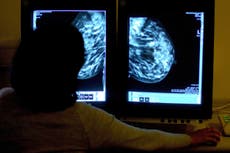 Women urged to attend breast screening to catch cancer early