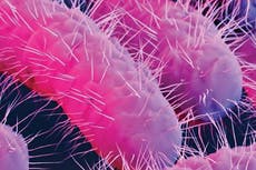 Thirty-two people infected with shigellosis after eating at Seattle restaurant