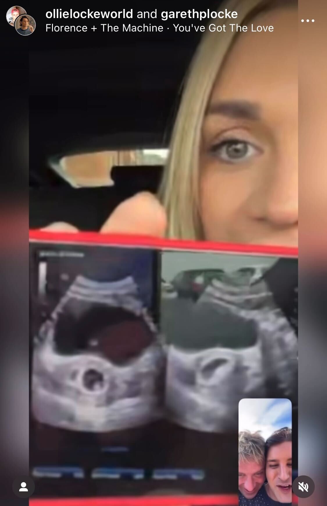 Ollie and Gareth Locke in a video call with their surrogate, Rebecca Ward, as they revealed they are expecting twins