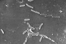 How officials cracked case of eyedrops that blinded people